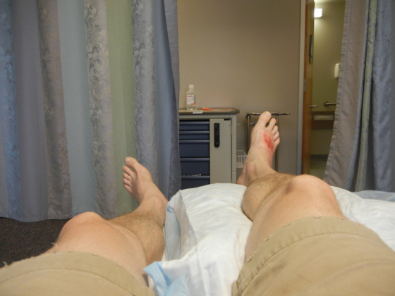 It wouldn't be an adventure without a visit to urgent care - surfing accident that got infected.